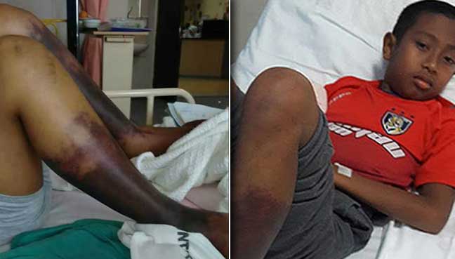 Eksklusif! Hari Ini Saya Menangis Sama Seperti Hari 